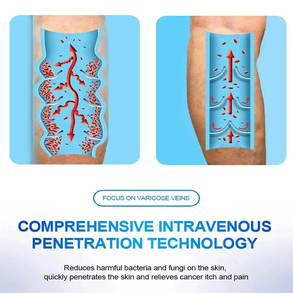 Varicose Vein Scar Therapy Pen