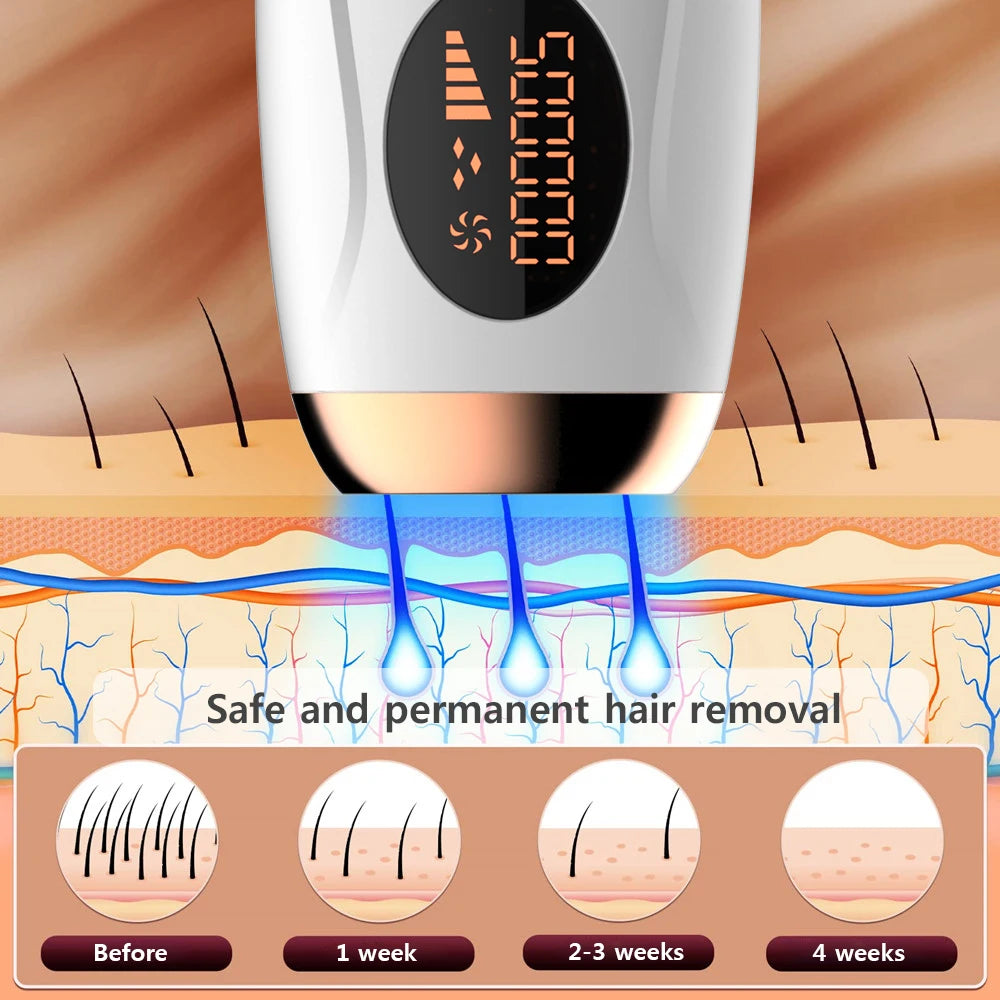 Portable IPL Laser Epilator