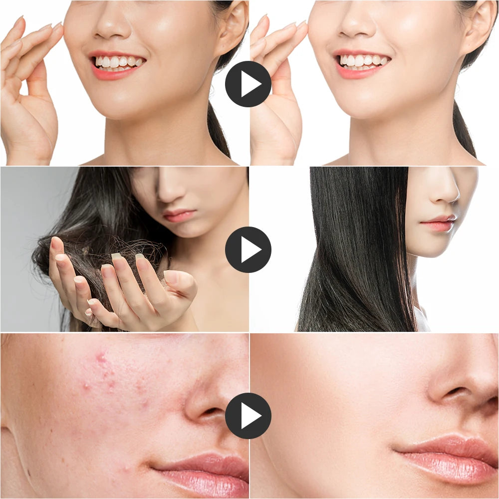 4-in-1 Portable High Frequency Facial Device