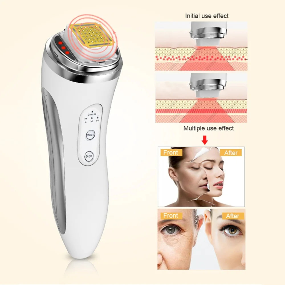 RF Face Lifting Tightening Beauty Device