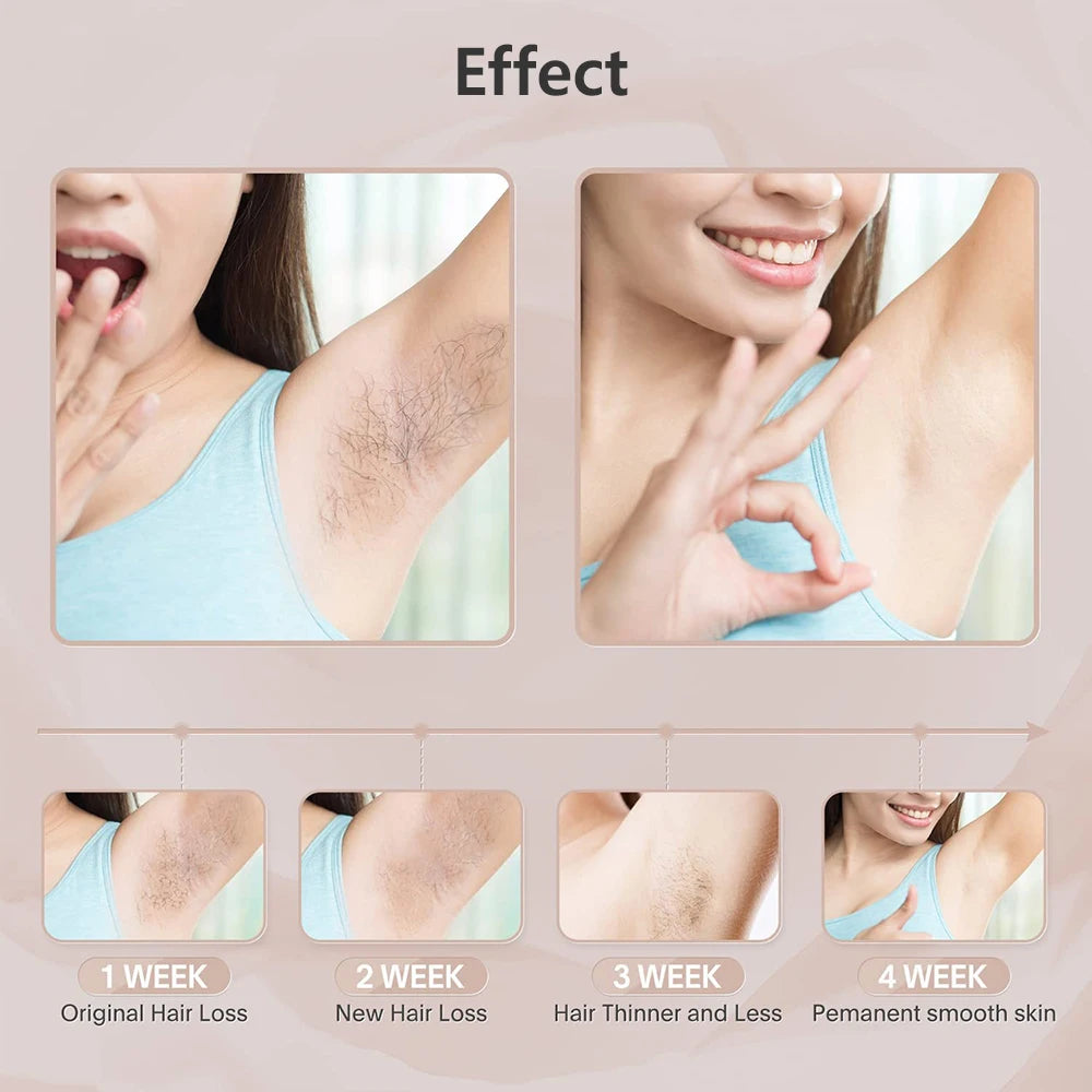 Portable IPL Laser Epilator