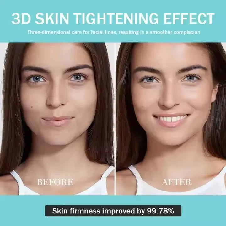 Anti Aging Microcurrent Lift Face Therapy